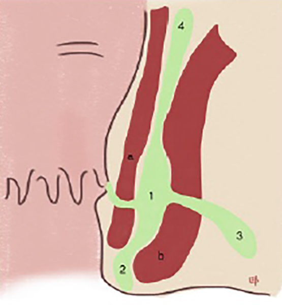 Hindlar bilan millatlararo porno